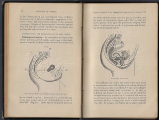 The Student's Guide to the Diseases of Women